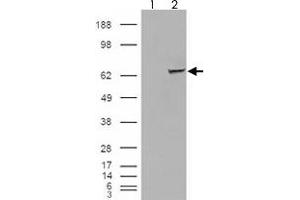 293 overexpressing IGF2BP2 and probed with IGF2BP2 polyclonal antibody  (mock transfection in first lane), tested by Origene.