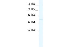 WB Suggested Anti-HCLS1 Antibody Titration:  1. (HCLS1 Antikörper  (N-Term))