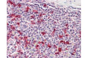 Anti-PTMA antibody IHC of human spleen. (PTMA Antikörper  (AA 89-101))