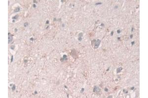 Detection of USP6NL in Human Cerebrum Tissue using Polyclonal Antibody to USP6 N-Terminal Like Protein (USP6NL)