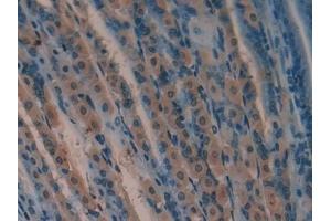 Immunohistochemistry (IHC) image for anti-Superoxide Dismutase 2, Mitochondrial (SOD2) (AA 25-222) antibody (ABIN7429205)