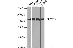 Western blot analysis of extracts of various cell lines using PPP2R3B Polyclonal Antibody at dilution of 1:1000. (PPP2R3B Antikörper)