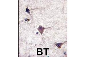 Formalin-fixed and paraffin-embedded human brain tissue reacted with hPCPTP1-, which was peroxidase-conjugated to the secondary antibody, followed by DAB staining. (PTPRR Antikörper  (N-Term))