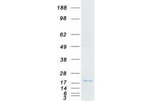 Validation with Western Blot (PTP4A3 Protein (Transcript Variant 2) (Myc-DYKDDDDK Tag))