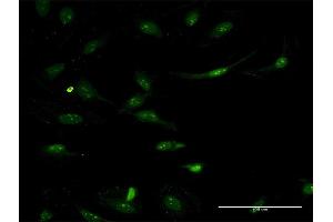 Immunofluorescence of monoclonal antibody to ASS1 on HeLa cell. (ASS1 Antikörper  (AA 121-220))