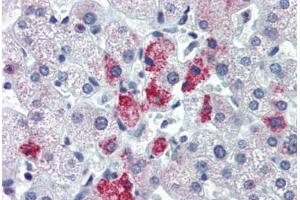 Human Liver (formalin-fixed, paraffin-embedded) stained with HMGN1 antibody ABIN462182 followed by biotinylated goat anti-rabbit IgG secondary antibody ABIN481713, alkaline phosphatase-streptavidin and chromogen. (HMGN1 Antikörper  (AA 36-85))