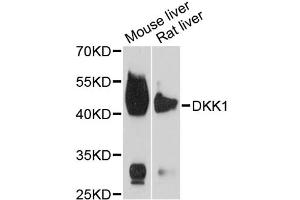 Western blot analysis of extracts of various cell lines, using DKK1 antibody (ABIN5971387) at 1/1000 dilution. (DKK1 Antikörper)