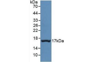 Detection of Recombinant TTR, Human using Monoclonal Antibody to Prealbumin (PALB) (TTR Antikörper  (AA 21-147))