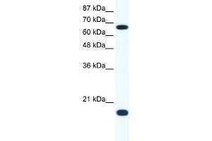 WB Suggested Anti-CUL1 Antibody Titration:  1. (Cullin 1 Antikörper  (C-Term))