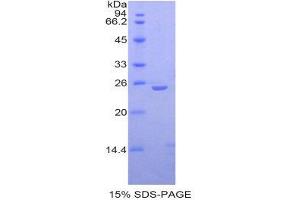 SDS-PAGE (SDS) image for Interleukin-27 Subunit alpha (IL27) (AA 32-234) protein (His tag) (ABIN2121455)