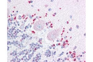 Immunohistochemistry (IHC) image for anti-Wingless-Type MMTV Integration Site Family, Member 7A (WNT7A) (Internal Region) antibody (ABIN1049483)