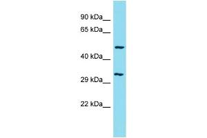 Western Blotting (WB) image for anti-Chromosome 1 Open Reading Frame 124 (C1orf124) (C-Term) antibody (ABIN2791211) (Spartan Antikörper  (C-Term))