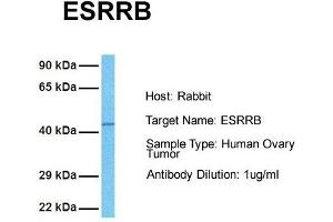 Host: Rabbit Target Name: ESRRB Sample Tissue: Human Ovary Tumor Antibody Dilution: 1. (ESRRB Antikörper  (N-Term))