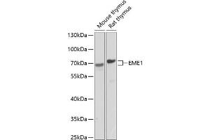 Western blot analysis of extracts of various cell lines, using EME1 antibody (ABIN6127301, ABIN6140155, ABIN6140156 and ABIN6224416) at 1:1000 dilution. (Crossover junction endonuclease EME1 (EME1) (AA 1-320) Antikörper)