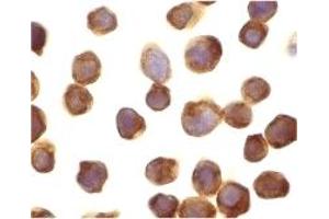 Immunohistochemistry (IHC) image for anti-Death-Associated Protein Kinase 3 (DAPK3) (Middle Region) antibody (ABIN1031183) (DAPK3 Antikörper  (Middle Region))