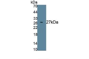 Detection of Recombinant KLK3, Rat using Polyclonal Antibody to Prostate Specific Antigen (PSA) (Prostate Specific Antigen Antikörper  (AA 68-255))