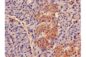 Immunohistochemistry (IHC) image for anti-Proteasome (Prosome, Macropain) Subunit, beta Type 2 (PSMB2) (AA 1-201) antibody (ABIN7164973)