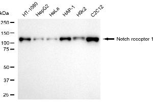 Western blotting analysis using notch receptor 1 antibody (ABIN7799625). (Rekombinanter Notch1 Antikörper)