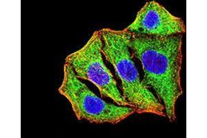 Immunocytochemistry (ICC) image for anti-Superoxide Dismutase 2, Mitochondrial (SOD2) (AA 1-222) antibody (ABIN5542467)