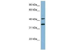 WB Suggested Anti-BLNK Antibody Titration:  0. (B-Cell Linker Antikörper  (Middle Region))