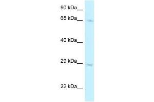Western Blot showing MUS81 antibody used at a concentration of 1 ug/ml against A549 Cell Lysate (MUS81 Antikörper  (C-Term))