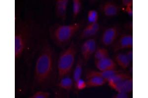 Immunofluorescence staining of methanol-fixed HeLa cells using NF-κB p105/p50 (phospho- Ser893) antibody (E011018 Red). (NFKB1 Antikörper  (pSer893))