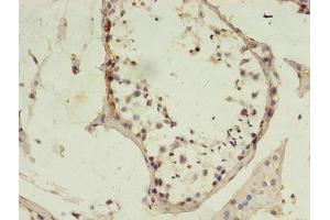 Immunohistochemistry of paraffin-embedded human testis tissue using ABIN7150209 at dilution of 1:100