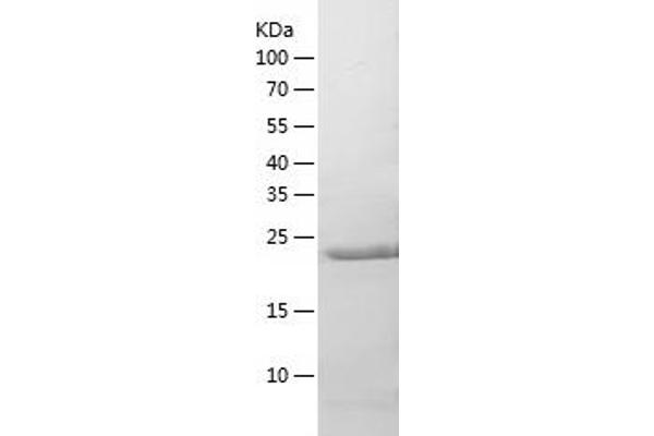 PSMB3 Protein (AA 1-246) (His tag)