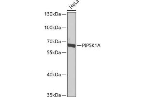 Western blot analysis of extracts of HeLa cells, using PIP5K1A antibody  at 1:1000 dilution. (PIP5K1A Antikörper  (AA 231-500))