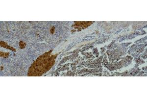 Immunohistochemistry of paraffin-embedded Mouse spleen tissue using IL2RA Monoclonal Antibody at dilution of 1:500 . (CD25 Antikörper)