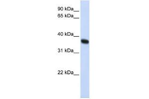 WB Suggested Anti-ZNF364 Antibody Titration:  0. (RNF115 Antikörper  (C-Term))