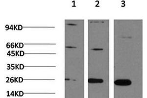 Western Blot analysis of 1) Hela, 2)3T3, 3) PC-12 cells using CBX3 Monoclonal Antibody at dilution of 1:1000. (CBX3 Antikörper)