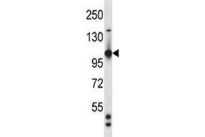 Tie1 antibody western blot analysis in mouse heart tissue lysate (TIE1 Antikörper  (AA 361-389))