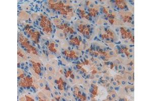 Used in DAB staining on fromalin fixed paraffin- embedded stomach tissue (MCCC2 Antikörper  (AA 380-563))