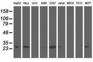 Image no. 3 for anti-Adenylate Kinase 4 (AK4) antibody (ABIN1496524) (AK4 Antikörper)