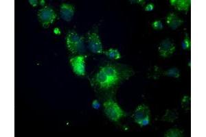 Anti-CRYAB mouse monoclonal antibody (ABIN2452579) immunofluorescent staining of COS7 cells transiently transfected by pCMV6-ENTRY CRYAB (RC202718). (CRYAB Antikörper)