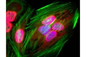ICC staining of human HeLa cells using recombinant Acetyl Lysine antibody (red).