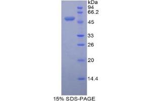 SDS-PAGE analysis of Mouse Peroxiredoxin 3 Protein. (Peroxiredoxin 3 Protein (PRDX3))