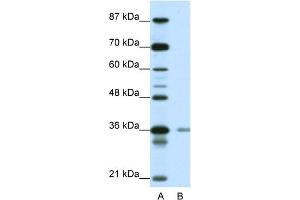 WB Suggested Anti-HIF1AN Antibody Titration:  0. (HIF1AN Antikörper  (N-Term))