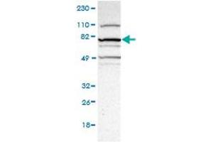 Western Blot (Cell lysate) analysis of RT-4 cell lysate.