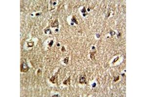 IHC analysis of FFPE human brain tissue stained with RAN antibody (RAN Antikörper  (AA 12-39))