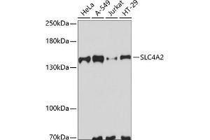 Western blot analysis of extracts of various cell lines, using SLC4 antibody (ABIN6129885, ABIN6148011, ABIN6148012 and ABIN6223666) at 1:3000 dilution. (SLC4A2 Antikörper  (AA 200-300))