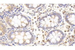 Detection of PLCd4 in Human Colon Tissue using Polyclonal Antibody to Phospholipase C Delta 4 (PLCd4) (PLCD4 Antikörper  (AA 1-250))