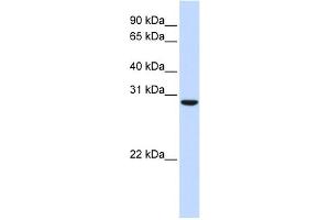 WB Suggested Anti-C18orf10 Antibody Titration: 0. (TPGS2 Antikörper  (Middle Region))