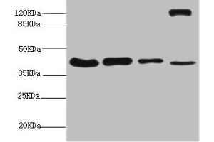 Western blot All lanes: NSFL1C antibody at 6. (NSFL1C Antikörper  (AA 1-185))