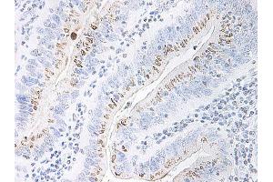 Image no. 1 for anti-Chemokine (C-X-C Motif) Ligand 2 (CXCL2) antibody (ABIN465915) (CXCL2 Antikörper)