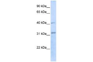 WB Suggested Anti-STUB1 Antibody Titration:  0. (STUB1 Antikörper  (C-Term))