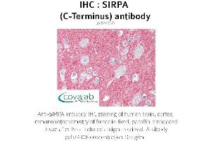 Image no. 2 for anti-Signal-Regulatory Protein alpha (SIRPA) antibody (ABIN1739273) (SIRPA Antikörper)