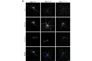 Representative confocal images showing the morphology of DIV21 primary hippocampal neurons over-producing mCherry (blue, circle highlights the complexity in panel 2, i. (Ankyrin G Antikörper)