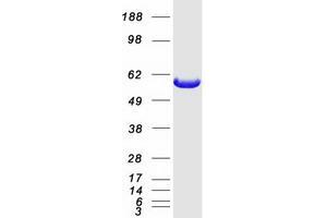 Western Blotting (WB) image for Interferon-Induced Protein with Tetratricopeptide Repeats 3 (IFIT3) (Transcript Variant 1) protein (Myc-DYKDDDDK Tag) (ABIN2723305)